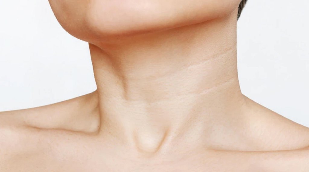 skin care tips, neck care,Neck Wrinkles and blackness,