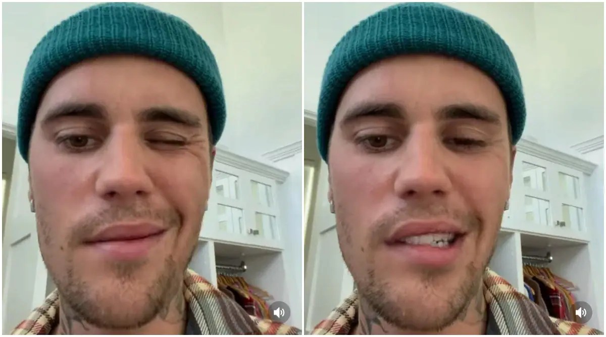 justin bieber, Ramsay Hunt syndrome