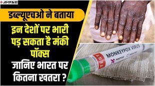 Monkeypox , Corona virus, covid-19, latest news,