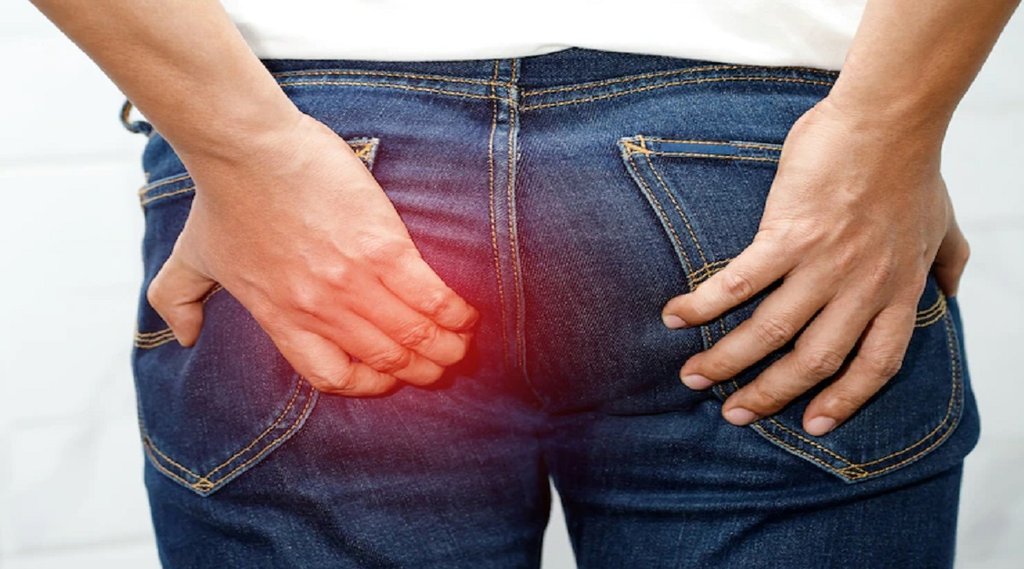 piles,fissure, fistula, piles symptoms and cure,fissure symptoms and cure