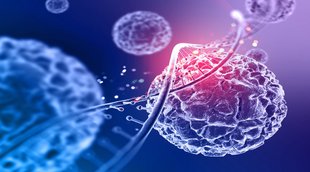 प्रोस्टेट कैंसर के लक्षण, प्रोस्टेट कैंसर का इलाज, प्रोस्टेट कैंसर, prostate cancer,