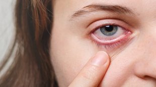 Dark Circle | Eyes Care