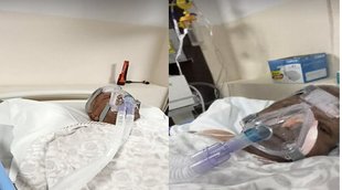 lalu prasad yadav news,lalu news,lalu yadav health update