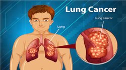 World Lung Cancer Day: सांस लेने में महसूस होती है तकलीफ? फेफड़ों में गंदगी हो सकती है प्रमुख वजह; जानिए