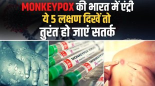 मंकी पॉक्स,मंकी पॉक्स वायरस, monkeypox in india,monkey pox in india,monkeypox symptoms,monkeypox in europe,monkeypox virus,monkeypox virus news,monkeypox virus symptoms,monkeypox outbreak,what is monkeypox virus,monkeypox disease,monkeypox symptoms,monkeypox virus structure,monkeypox virus treatment,monkeypox virus life cycle,monkeypox virus in uk