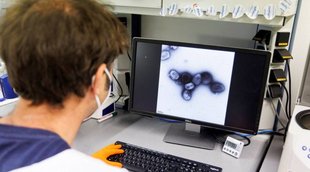 Monkeypox, Virus