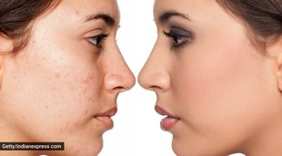 Skin care, Life Style, Health