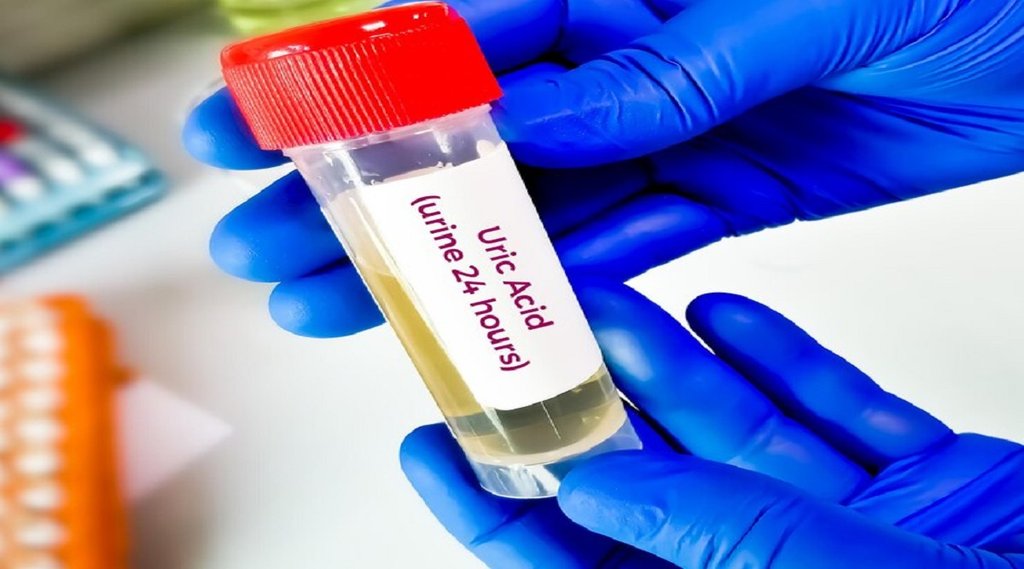 uric acid ,joint pain