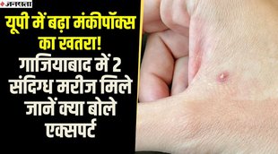 monkeypox,monkeypox virus,monkeypox precautions,monkeypox india,what is monkeypox,monkeypox symptoms