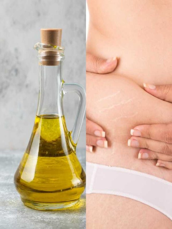 MUSTARD OIL CAN REMOVE STRETCH MARKS
