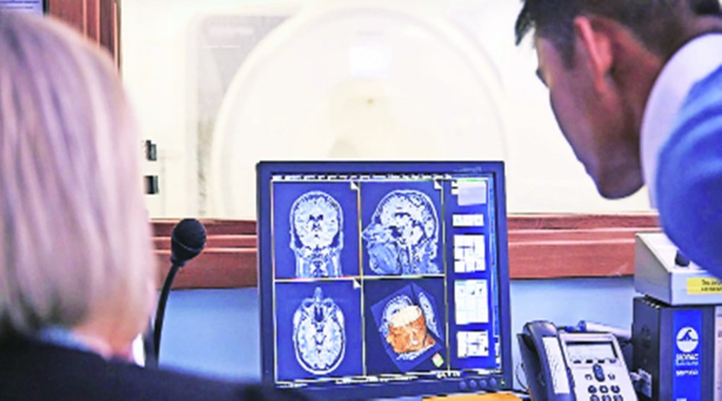 Health issue, health problem, Alzheimer, Alzheimer causes, Alzheimer symptoms,