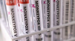 Delhi monkeypox | fifth case of monkeypox delhi | LNJP hospital