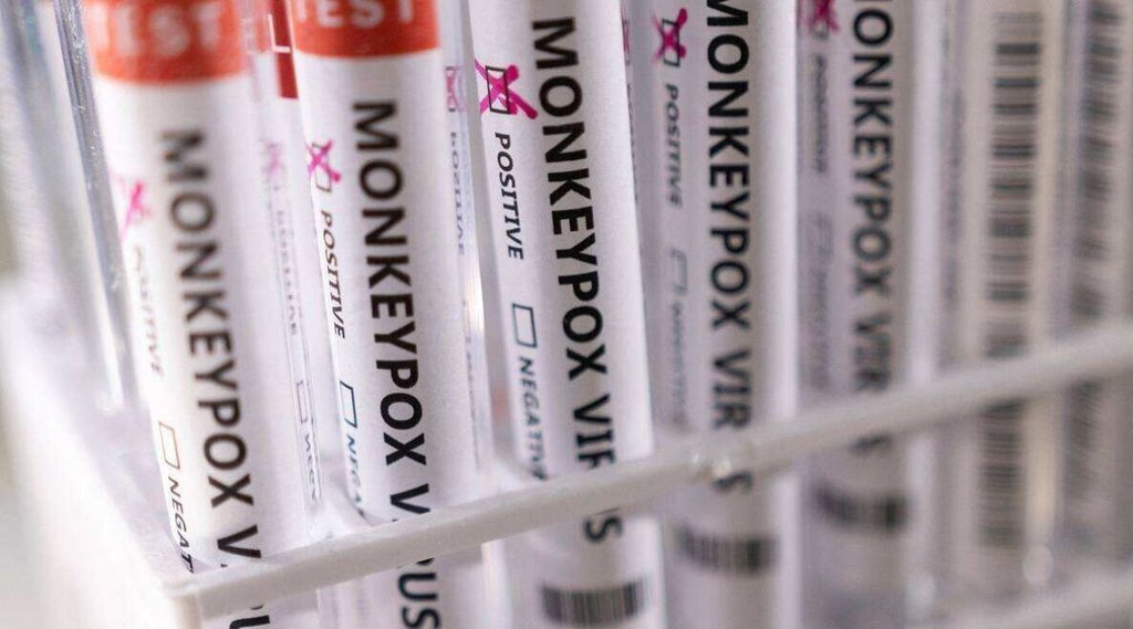 Delhi monkeypox | fifth case of monkeypox delhi | LNJP hospital
