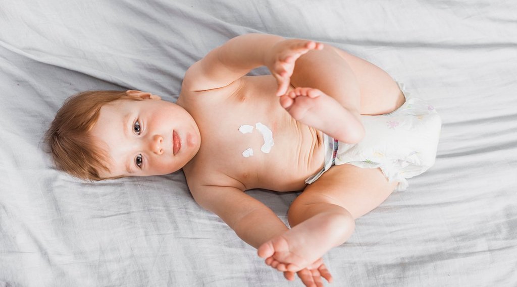 Monsoon Rashes, Monsoon Rashes In Babies, Babies skin care,