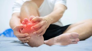 uric acid, uric acid control tips, uric acid reduction tips,