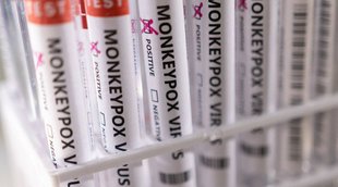 monkeypox Cases