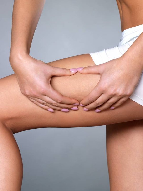 cellulite skin on her legs