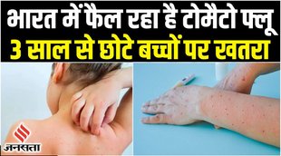 tomato flu,tomato flu in india,कोरोना,tomato flu symptoms,मंकीपॉक्स,tomato flu in kerala,monkeypox cases in india,tomato flu news,covid cases in india,what is tomato flu,tomato flu kerala