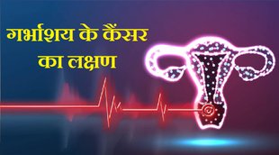 Ovarian cancer, Ovarian cancer Diseases & Conditions, Ovarian cancer, Symptoms & causes, Ovarian cancer Diagnosis & treatment