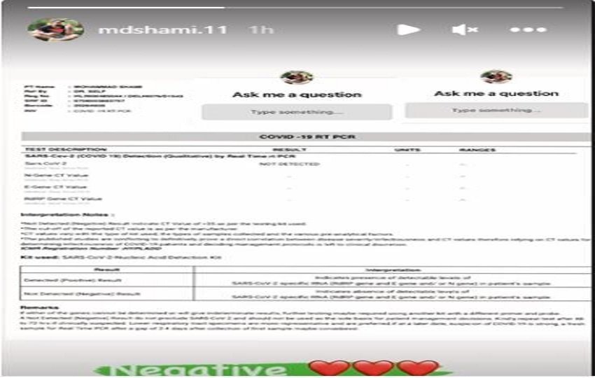 Mohammed Shami Covid Negative | Mohammed Shami | Mohammed Shami Covid Report