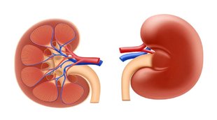uric acid, low uric acid,Fanconi syndrome cause