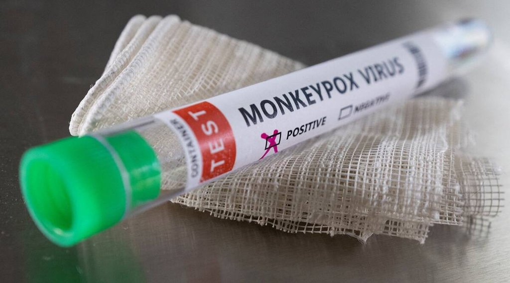Monkeypox, China, Wu Zunyou