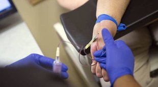 Hepatitis