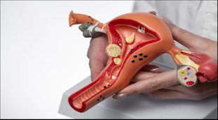 Cervical cancer Vaccine, Cervical cancer symptoms, Cervical cancer causes,