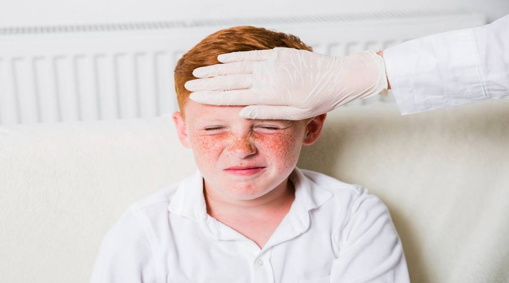 chickenpox prevention, chickenpox in adults ,chickenpox vaccine