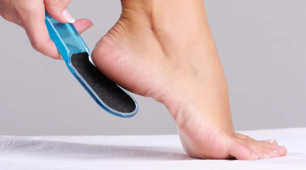 How to heal cracked heels,cracked heels home remedies,