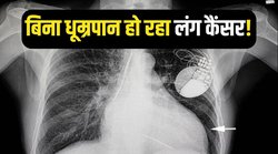 Lung Cancer: धूम्रपान न करने वाले लोगों को भी हो रहा है लंग कैंसर, जानिए कारण