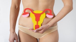 Polycystic Ovary Syndrome, causes,