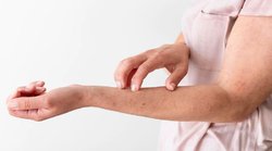 Diabetes: डायबिटीज मरीजों को क्यों होती है खुजली की परेशानी? जानिये कारण और रोकथाम के उपाय