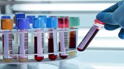 रक्त परीक्षण, जो एक साथ कई कैंसर की जांच करता है