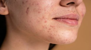 Air pollution,Health,Wellness,Skin,Pollution,Smog