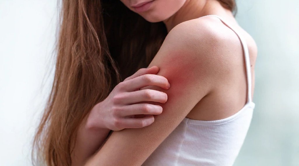 symptoms on the skin can be sign of high blood sugar,diabetes,blood sugar increase symptoms on skin, diabetes patients, blisters,