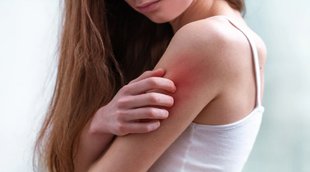 symptoms on the skin can be sign of high blood sugar,diabetes,blood sugar increase symptoms on skin, diabetes patients, blisters,