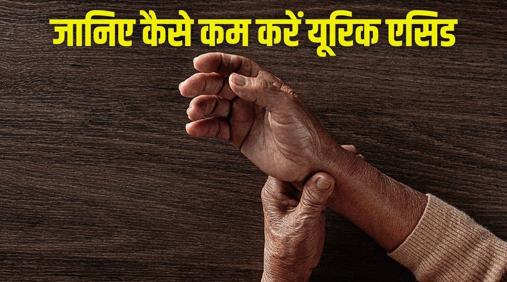 uric acid, uric acid control tips, uric acid causes