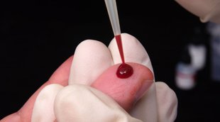 blood clotting symptoms, blood clotting symptoms in hindi, blood clotting causes
