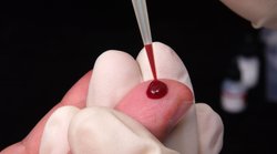 Blood Clotting Signs: शरीर में दिख रहे ये 5 लक्षण हैं खून के थक्के बनने के संकेत, समय रहते नहीं हुए सावधान तो जा सकती है जान!