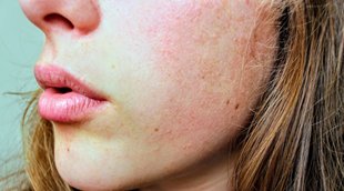 winter skin care tips in hindi, winter skin care tips, winter skin care routine, winter skin care homemade tips,