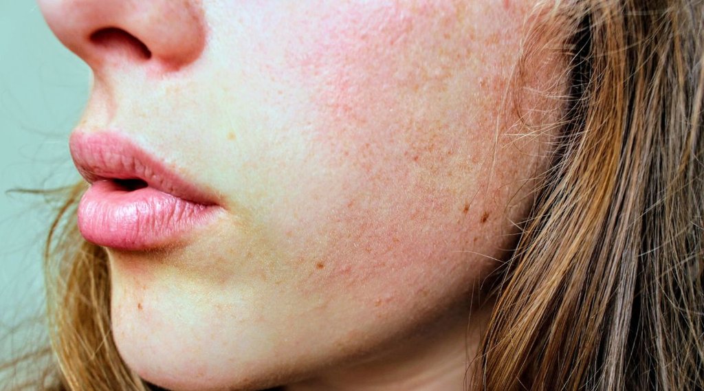 winter skin care tips in hindi, winter skin care tips, winter skin care routine, winter skin care homemade tips,