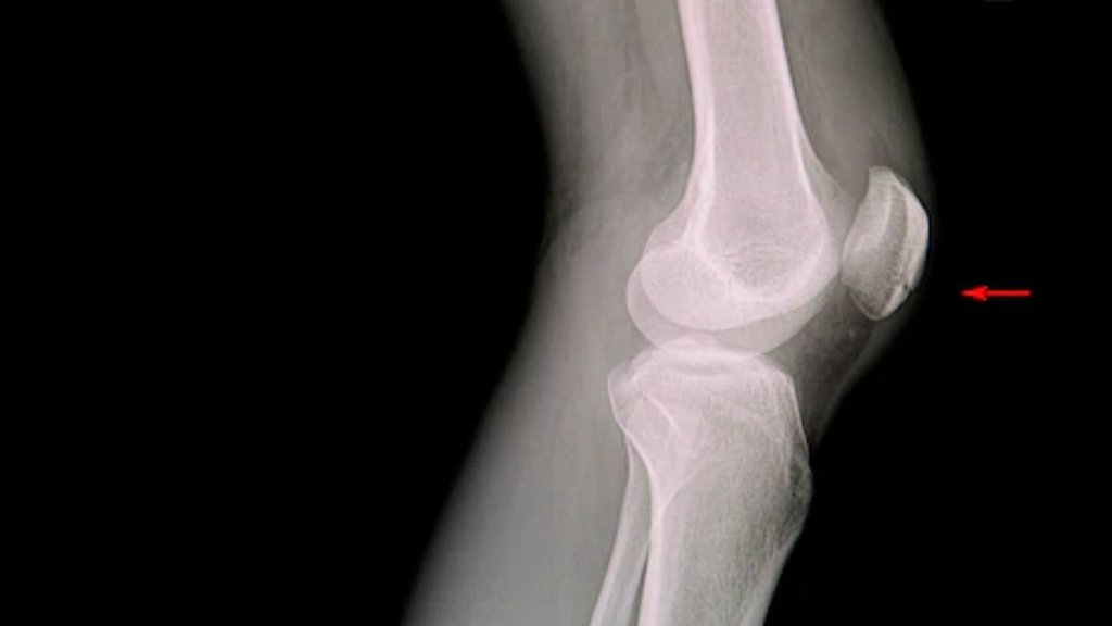 rishabh pant accident | rishabh pant news | rishabh pant property rishabh pant accident | rishabh pant news | rishabh pant property