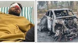 Rishabh Pant Accident: ऋषभ पंत पर भारी पड़ा सीट बेल्ट न लगाना, SUV में Knee Bag होने के बाद भी घुटने में लगी गंभीर चोट