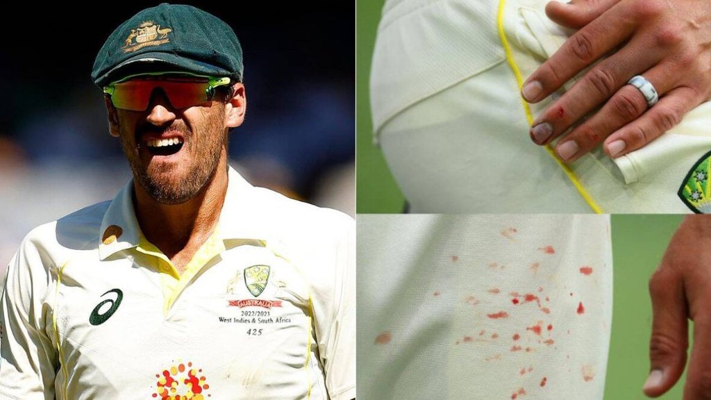 Starc