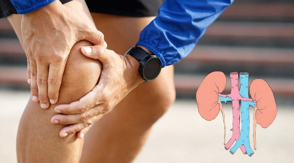 Uric Acid, Uric acid Treatment, Uric acid Diet