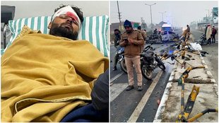 Rishabh Pant | Rishabh Pant Ligament Injury | Rishabh Pant Accident