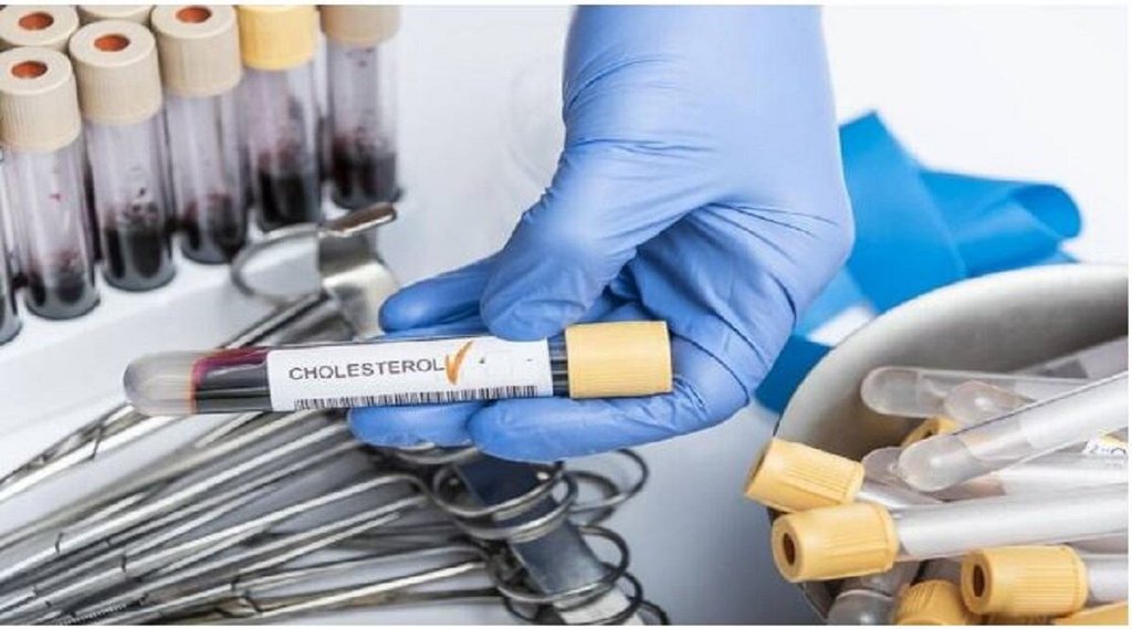 cholesterol control tips