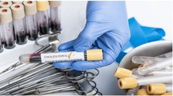 Cholesterol: इन 5 चीजों का मिक्स्चर शरीर से गायब कर देगा बैड कोलेस्ट्रॉल, बाबा रामदेव से जानिये