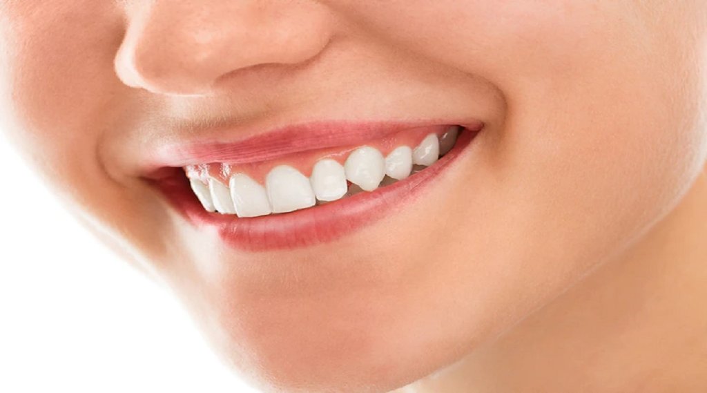 home remedies to whiten teeth